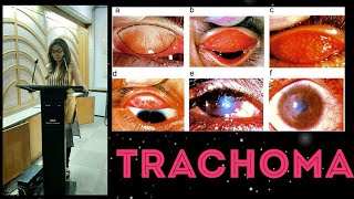 Trachoma  epidemiology causes signs and symptoms treatment prevention [upl. by Ait]