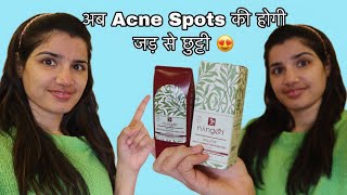 Ningen Acne Spot Correction Gel  Ningen Spot Corrector Gel  How To Remove Darkspots Face [upl. by Borreri335]