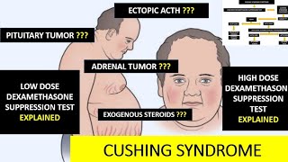 CUSHING SYNDROME  dexamethasone suppression test explained [upl. by Pippy594]