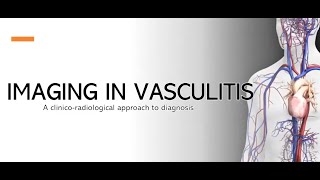 Imaging in Vasculitis [upl. by Nolan]