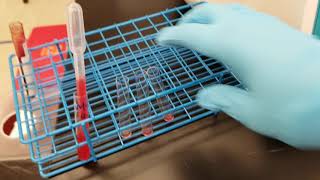 Blood Banking Fetomaternal Hemorrhage Screen Rosette test [upl. by Wappes]