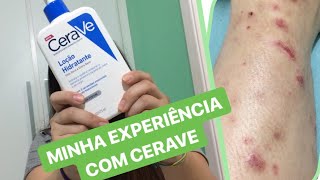 A VERDADE sobre o creme CERAVE [upl. by Roderich557]