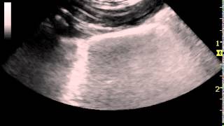 canine ultrasonography appearance of lungs with glide sign [upl. by Braeunig818]