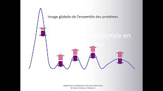 Un pic monoclonal à lélectrophorèse [upl. by Jerol]