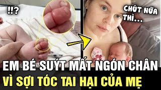 Em bé sơ sinh suýt MẤT NGÓN CHÂN vì sợi tóc của mẹ nhiều người cũng từng gặp phải  Tin nhanh 24h [upl. by Evadne]