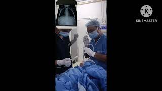 Esophagoscopy procedure to remove foreign bodyesophagoscopyRigid esophagoscopy [upl. by Ttelrahc]