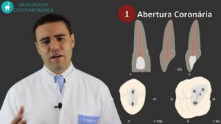 Preparo do Canal Radicular Com Segurança E Qualidade Em 5 Passos [upl. by Suki]