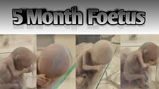 5 month foetus  The Second Trimester Your Babys Growth and Development in Middle Pregnancy [upl. by Fairfax358]