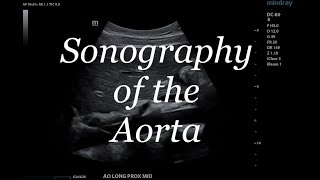 SONOGRAPHY OF THE AORTA [upl. by Iliak5]