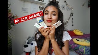 MY ACNE JOUREY  ISOTRETENOIN AND SELF LOVE [upl. by Aicarg]