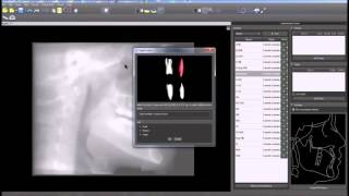 Blue Sky Plan Training Tutorial Ceph Functionality XRay and CT [upl. by Fem]