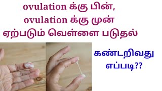 White discharge early pregnancy symptoms in Tamil வெள்ளைப்படுதல் கர்ப்ப அறிகுறிகள் [upl. by Keare937]