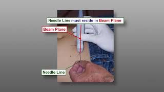 Fine Needle Aspiration Biopsy FNA Techniques  Ultrasound Guided FNA The Parallel Approach [upl. by Tillfourd]