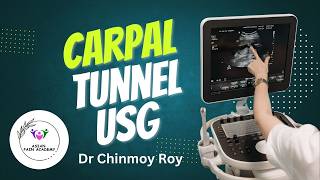 Sonoanatomy of Carpel tunnel [upl. by Sim241]