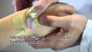 Semiologia do Punho  Testes Ligamentares [upl. by Ytsenoh]