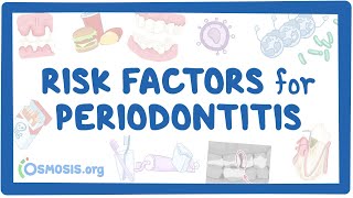 Risk Factors for Periodontitis [upl. by Hedley]