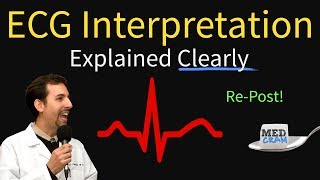 ECG Interpretation Explained Clearly and Succinctly  Arrhythmias Blocks Hypertrophy [upl. by Ahsrop]