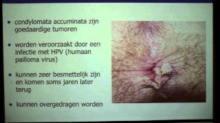 Anale condylomen  proctologie  Dr Tom Feryn [upl. by Nnylsor]