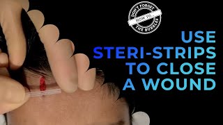 How to apply steristrips to a laceration  wound closure butterfly [upl. by Wilma201]