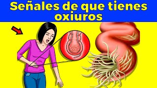 Señales de alarma de que tienes oxiuros parásitos intestinales [upl. by Bat]