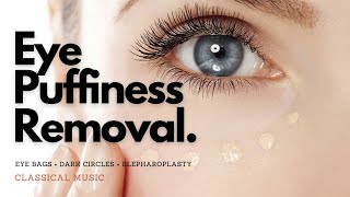 𝄞 Powerful Blepharoplasty  Remove Eye Puffiness  Eye Bags  Dark Circles  Classical Music [upl. by Hannahsohs]