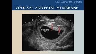 Ultrasound Training Course 09 part 1 [upl. by Araic]