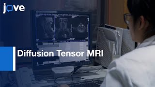 Diffusion Tensor MRI in Chronic Spinal Cord Compression  Protocol Preview [upl. by Ahsitul]