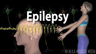 Epilepsy Types of seizures Symptoms Pathophysiology Causes and Treatments Animation [upl. by Lydnek693]