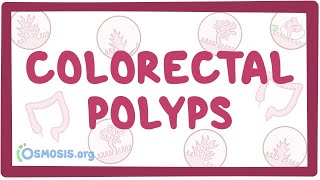 Colorectal polyps  an Osmosis Preview [upl. by See]