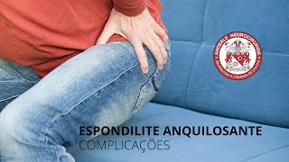 Espondilite Anquilosante COMPLICAÇÕES Dr Diogo Neurocirurgião [upl. by Rimahs]