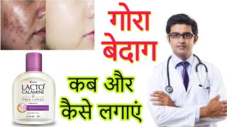 Lacto Calamine face lotion HONEST Review 2023 in hindi  Results Benefits Uses Price Info [upl. by Nanyt784]