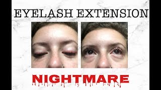 HOW TO DEAL WITH EYELASH EXTENSION IRRITATIONS [upl. by Noelopan]