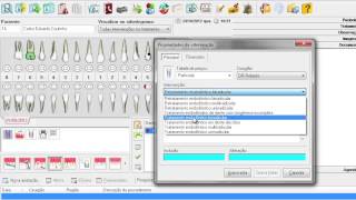 EasyDental  Elaborando um plano de tratamento [upl. by Turnheim134]