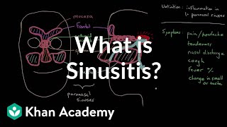 What is sinusitis  Respiratory system diseases  NCLEXRN  Khan Academy [upl. by Nairam]