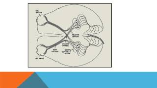 névrite optique [upl. by Atiuqrahc]