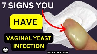 7 Signs You Have A Yeast Infection [upl. by Adlesirk]