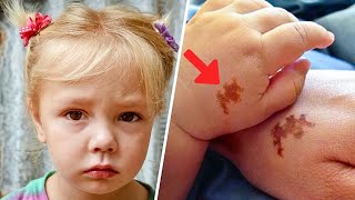 Mom Adopts Girl With Same Birthmark  She Screams When She Sees DNA Test Results [upl. by Anazus]