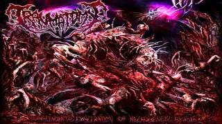 TRAUMATOMY  Strategic Dismemberment [upl. by Baudoin]