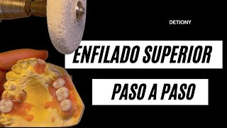 COMO enfilar Dientes en Protesis Parcial [upl. by Devonna]