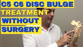 C5 C6 Disc Bulge Treatment Without Surgery  Bulging Disc C5 C6  Dr Walter Salubro [upl. by Furiya]