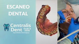 Servicio de Escaneo Intraoral  Centralisdent [upl. by Yenruoj]