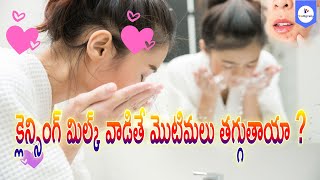 How to use Cleansing Milk on Face in Telugu  Is Cleansing Good For Skin  Cleansing Milk Uses [upl. by Onailime]