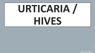 Urticaria  Hives  DERMATOLOGY  Rapid Revision  USMLE [upl. by Notelrac]