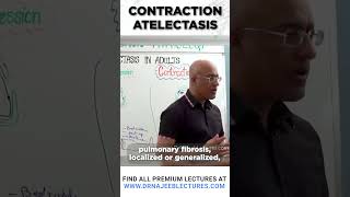 Contraction Atelectasis drnajeeb drnajeeblectures shortvideostatus [upl. by Car]