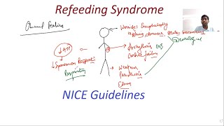 Refeeding Syndrome  NICE Guidelines  General Surgery Lectures  MRCS MS DNB [upl. by Alebasi]