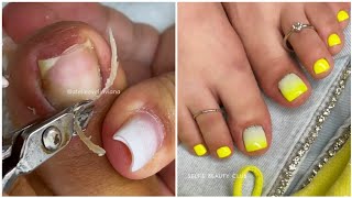 Most Satisfying Pedicure Transformation 😱 best nail polish for toes 2024 [upl. by Mattland]