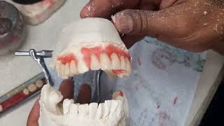 como enfilar una protesis dental  enfilado y festoneado  dentures [upl. by Wiedmann]