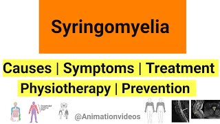 What is Syringomyelia  Pathophysiology  Symptoms  Physiotherapy Treatment [upl. by Melissa]