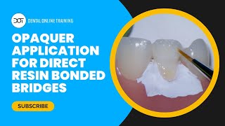 Opaquer Application for Direct Resin Bonded Bridge with Dr Dennis Hartlieb  Dental Online Training [upl. by Brogle]