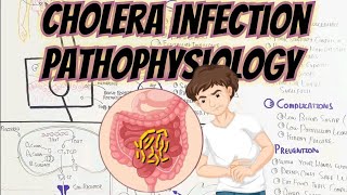 Cholera Infection Pathophysiology umerfarooqbiology7083 [upl. by Nosnah957]